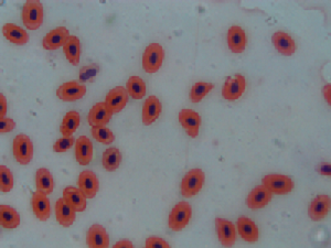 békavér-kenet magvas vörösvérsejtekkel