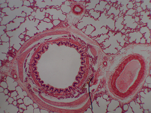 tüdőszövet mikroszkópos képe
